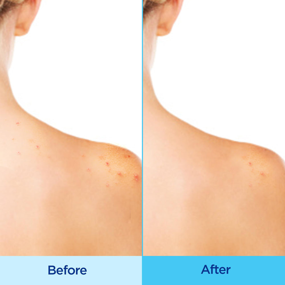 Differin fine mist texture close-up demonstrating even coverage and quick drying