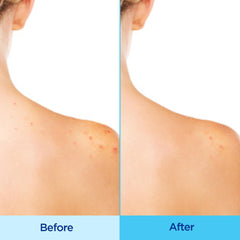 Differin fine mist texture close-up demonstrating even coverage and quick drying