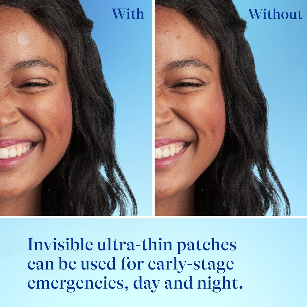 Differin patch under makeup showing invisible wear and blemish camouflage benefit