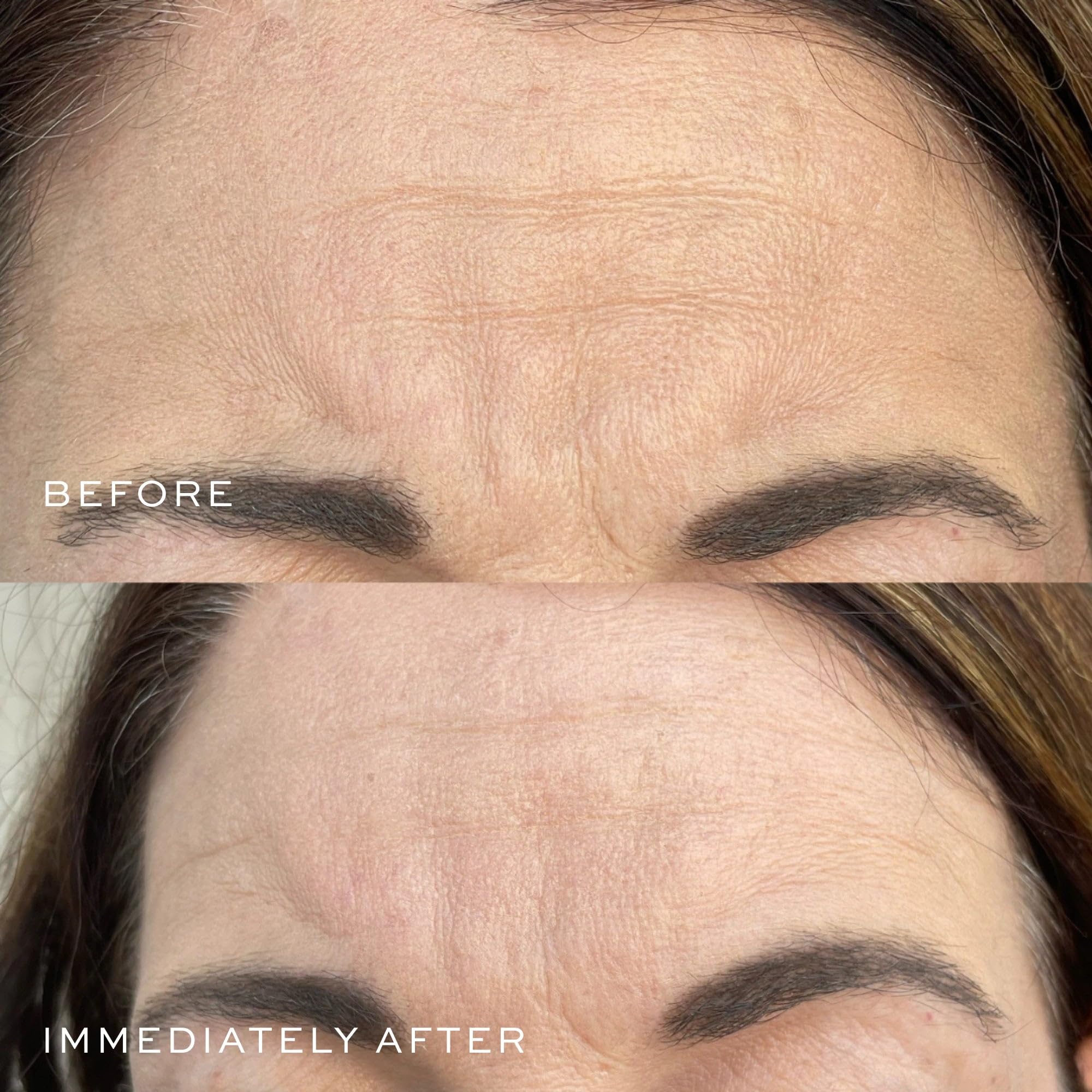 DIME Beauty Super Firm Serum eye-neck-area focus suggests smoothing around eyes and neck.