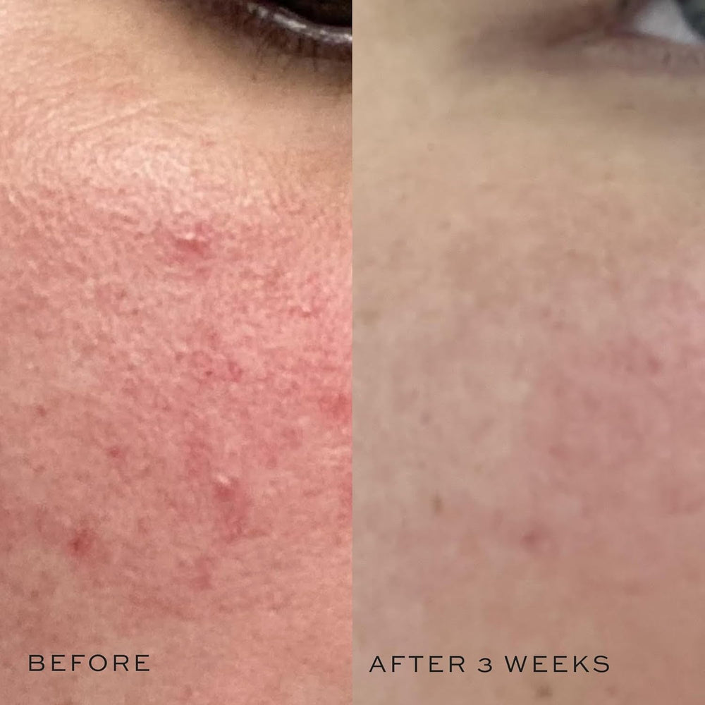 DIME Beauty Super Skin Toner application with cotton pad showcases easy daily use.
