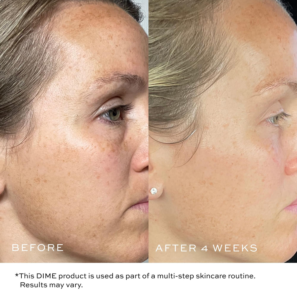 DIME Beauty TBT Cream orobanche-extract supports clear pores and refined texture.