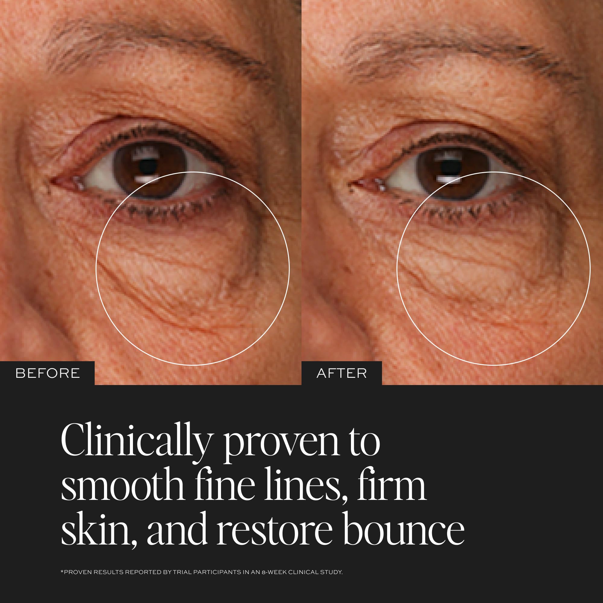 DIME TBT Eye Cream under-eye area shows hydrated, plump skin.