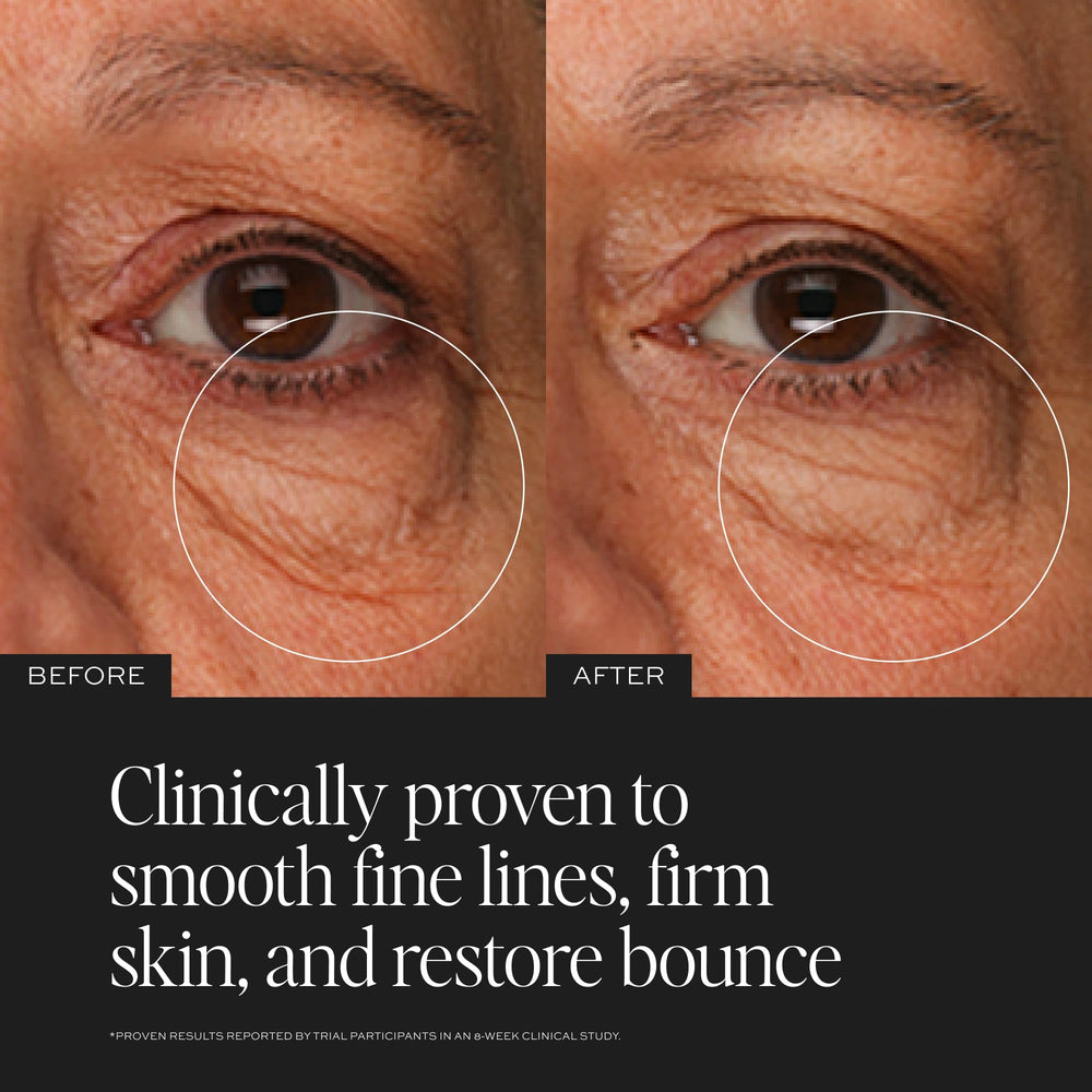 DIME TBT Eye Cream under-eye area shows hydrated, plump skin.