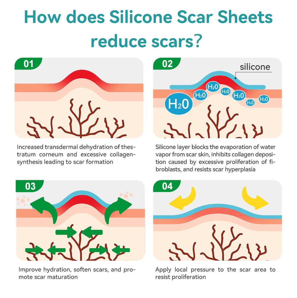 Dimora scar sheet cleaning drying emphasizes reusable, washable silicone between wears.