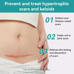 Dimora scar sheet wear on arm demonstrates comfortable daily use.