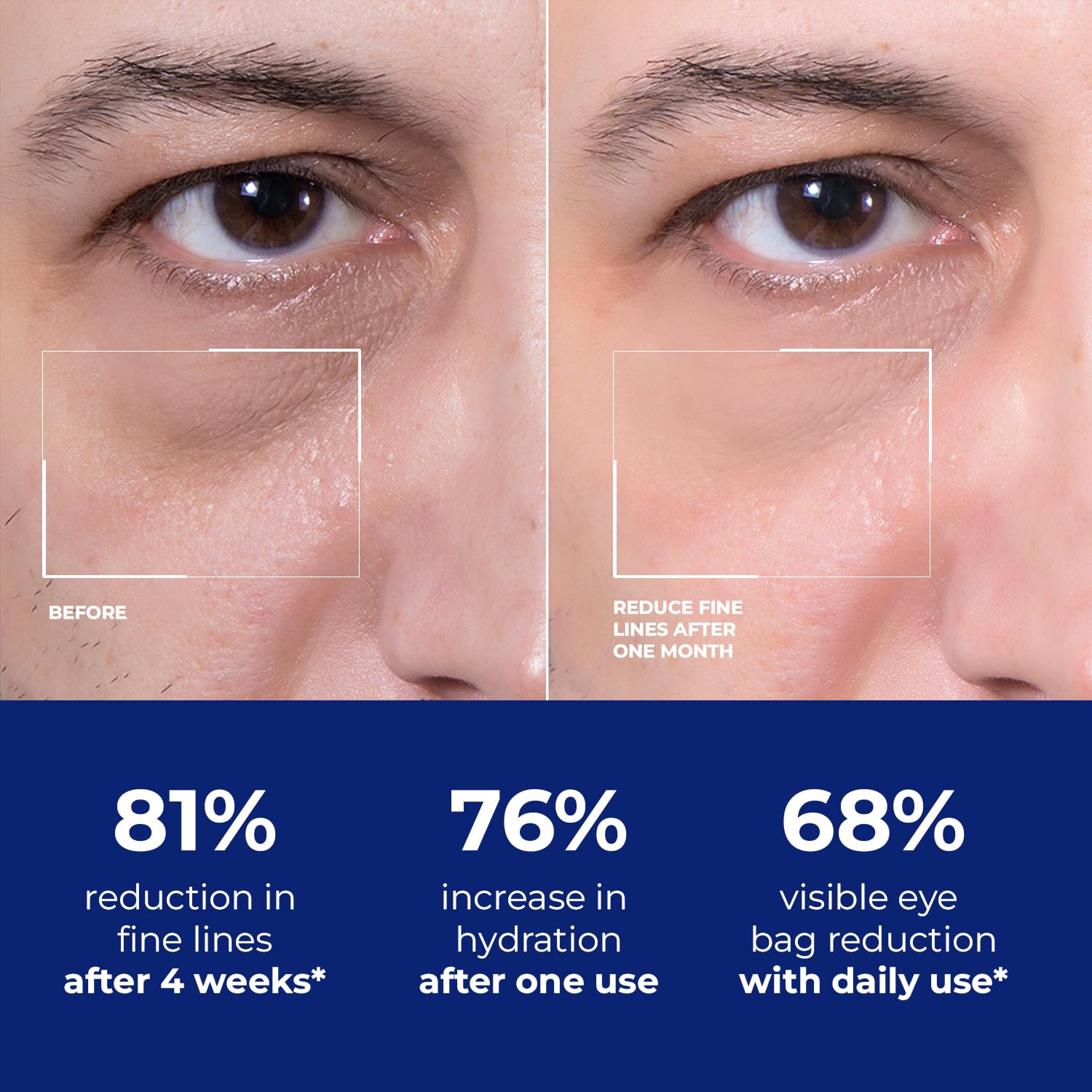 DIPSEVEN men's eye cream niacinamide brightening closeup suggests brighter under eyes