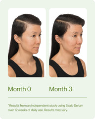 Divi Hair Vitamins capsules on glass surface suggesting convenient supplementation.