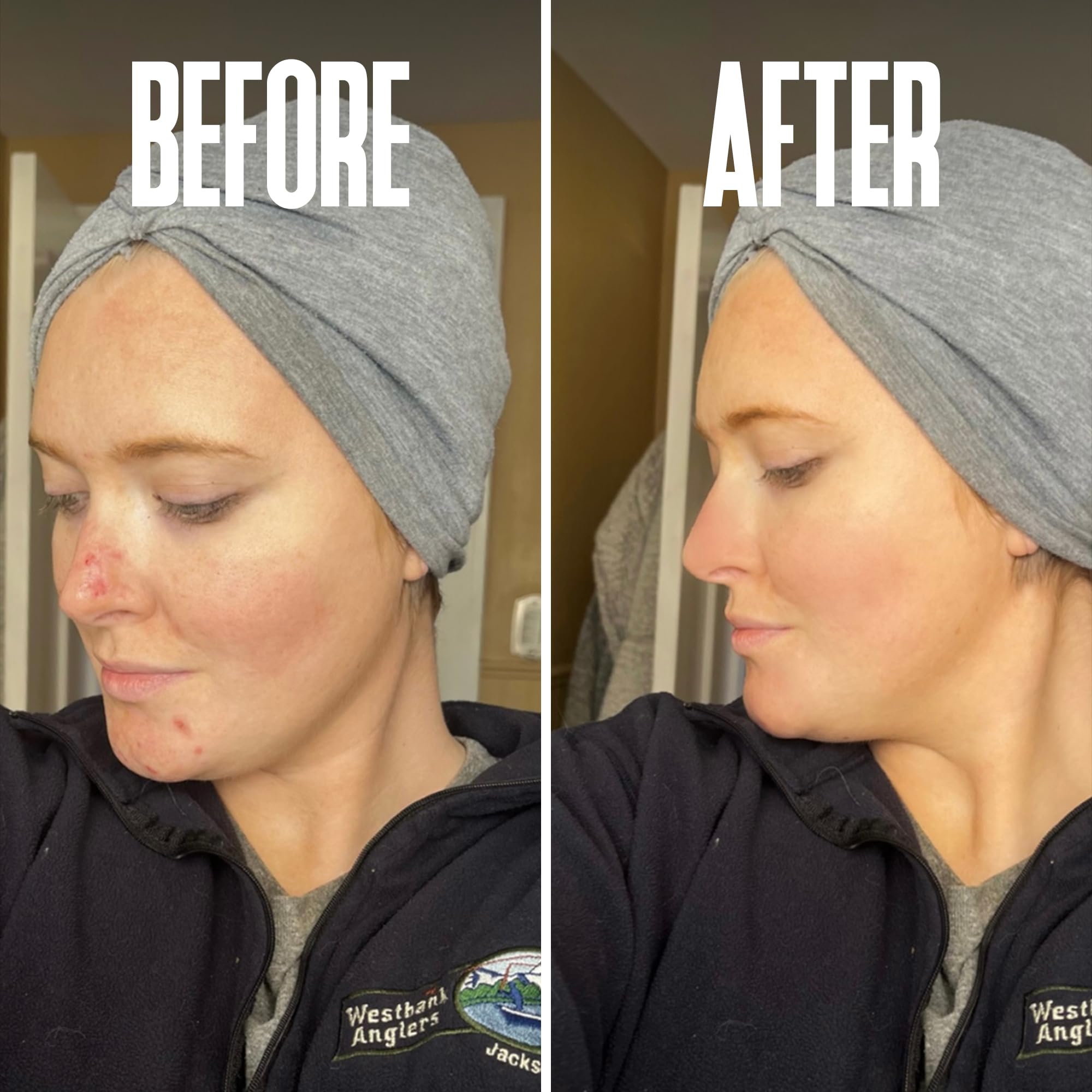 Divine Derriere skin-smoothing impression after using the glycolic peel