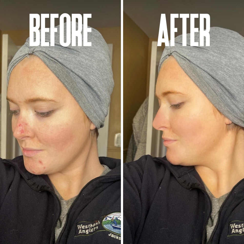 Divine Derriere skin-smoothing impression after using the glycolic peel