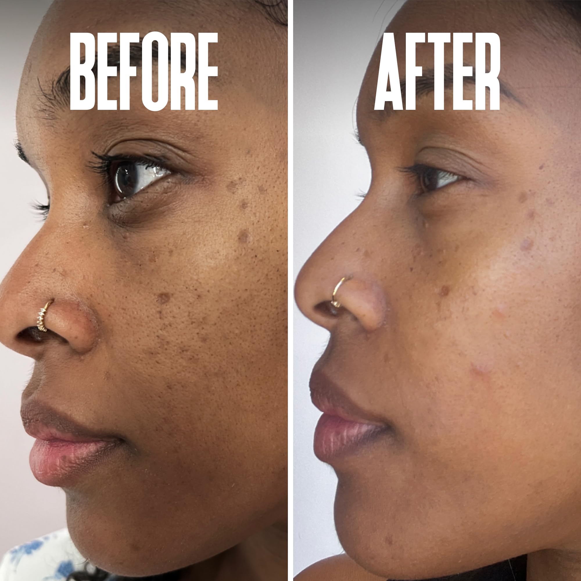 Divine Derriere Tyrostat HR plant extracts showcase peptide support
