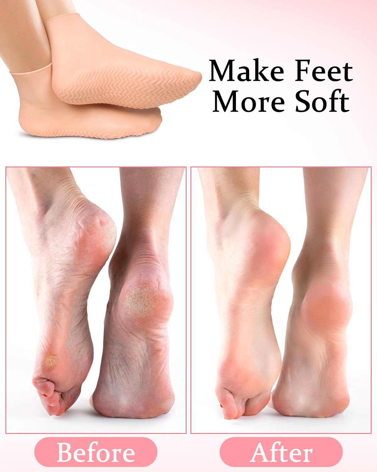 DLMDLM dual-pack silicone socks ready for home pedicure