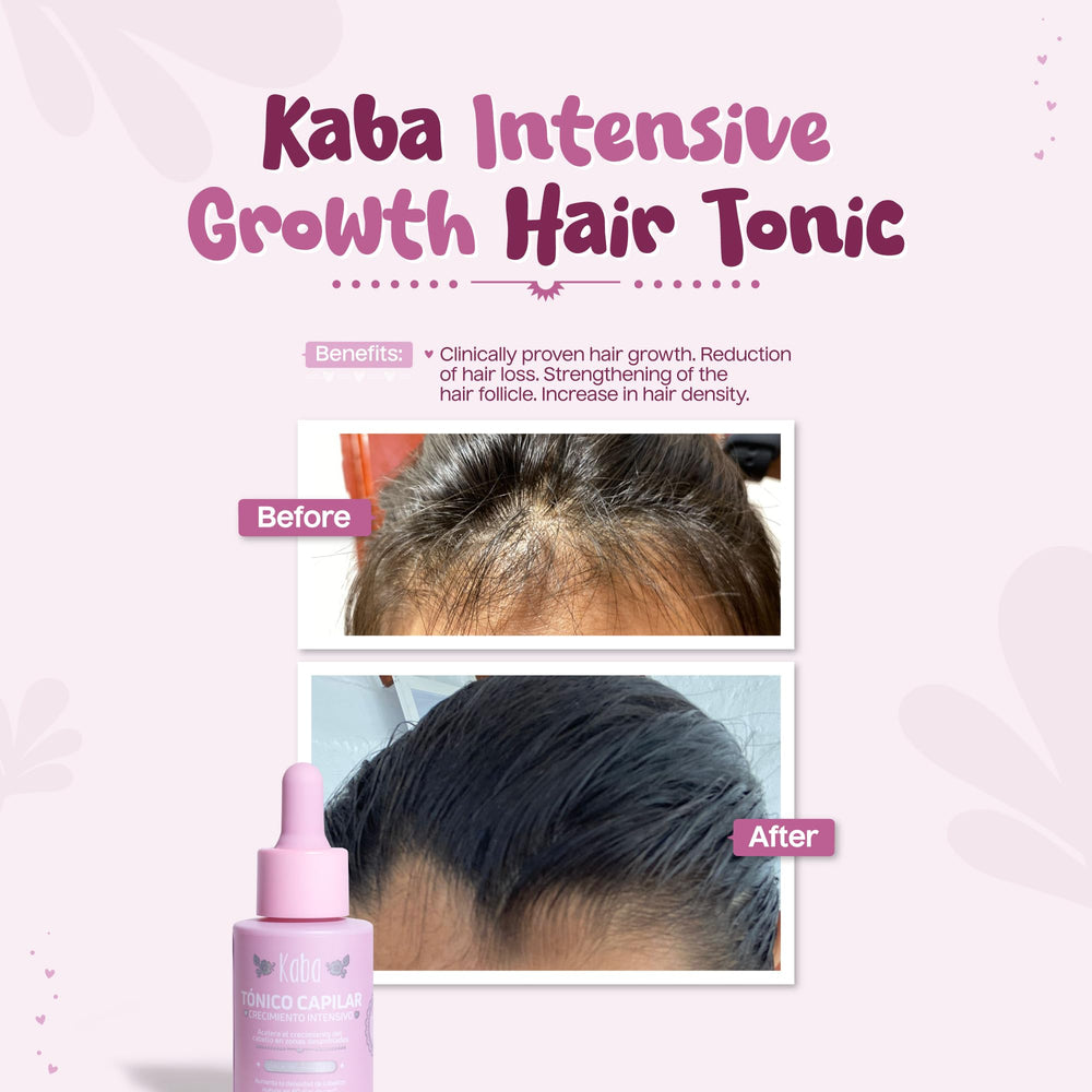 D'Luchi Kaba hair grow oil dropper provides precise, mess-free application