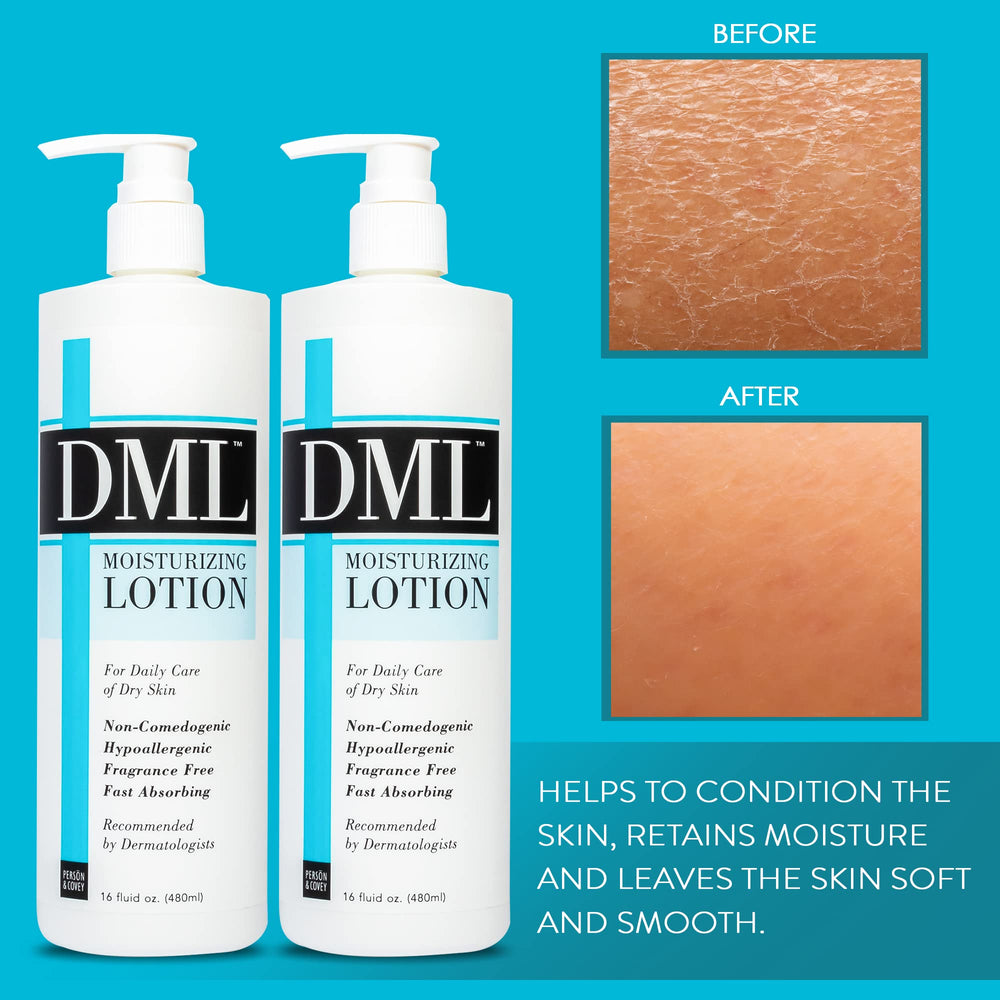 DML Moisturizing Lotion applied to dry hands for smooth, non-greasy absorption.