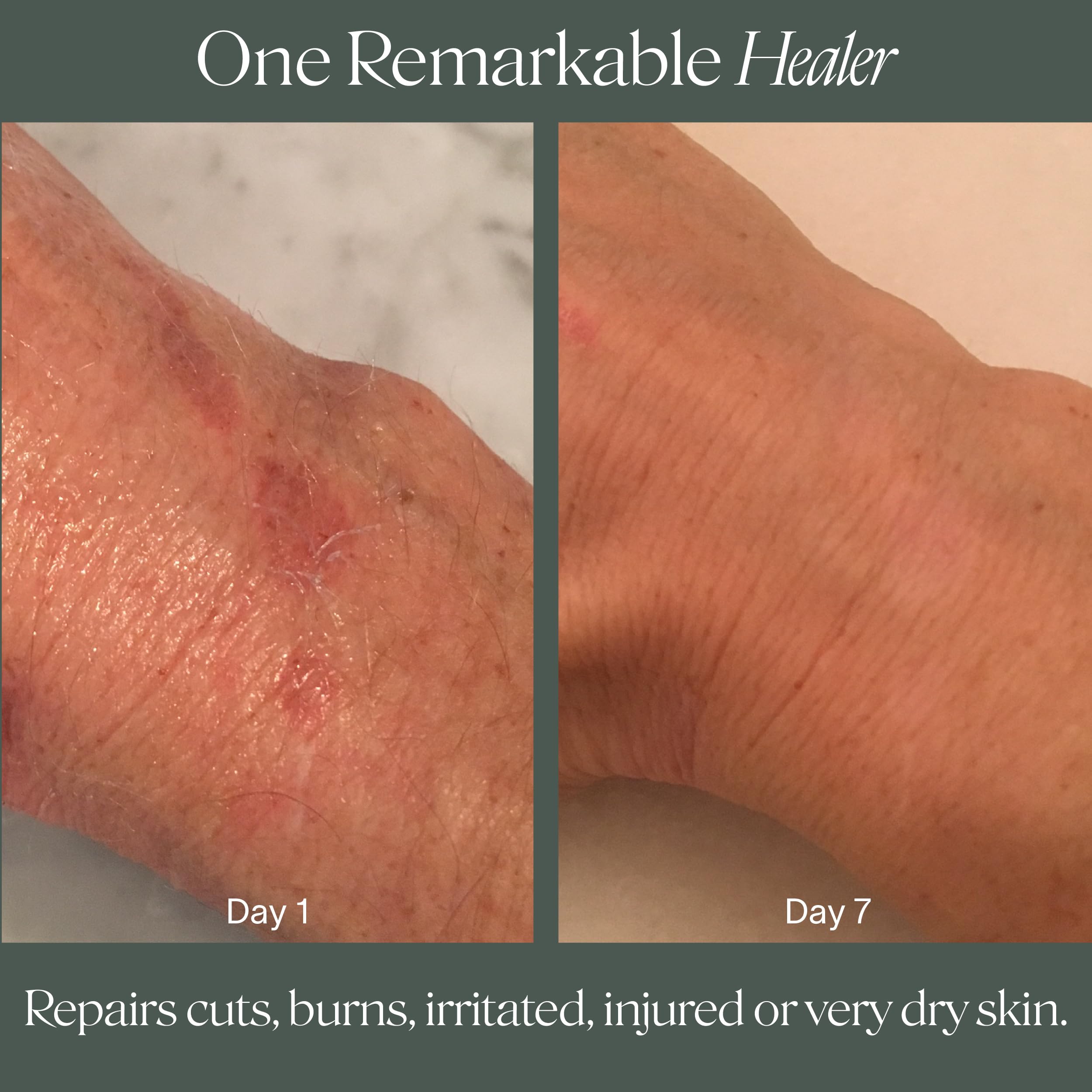 Doctor Rogers Restore Healing Balm for dry feet, hydration on cracked skin.