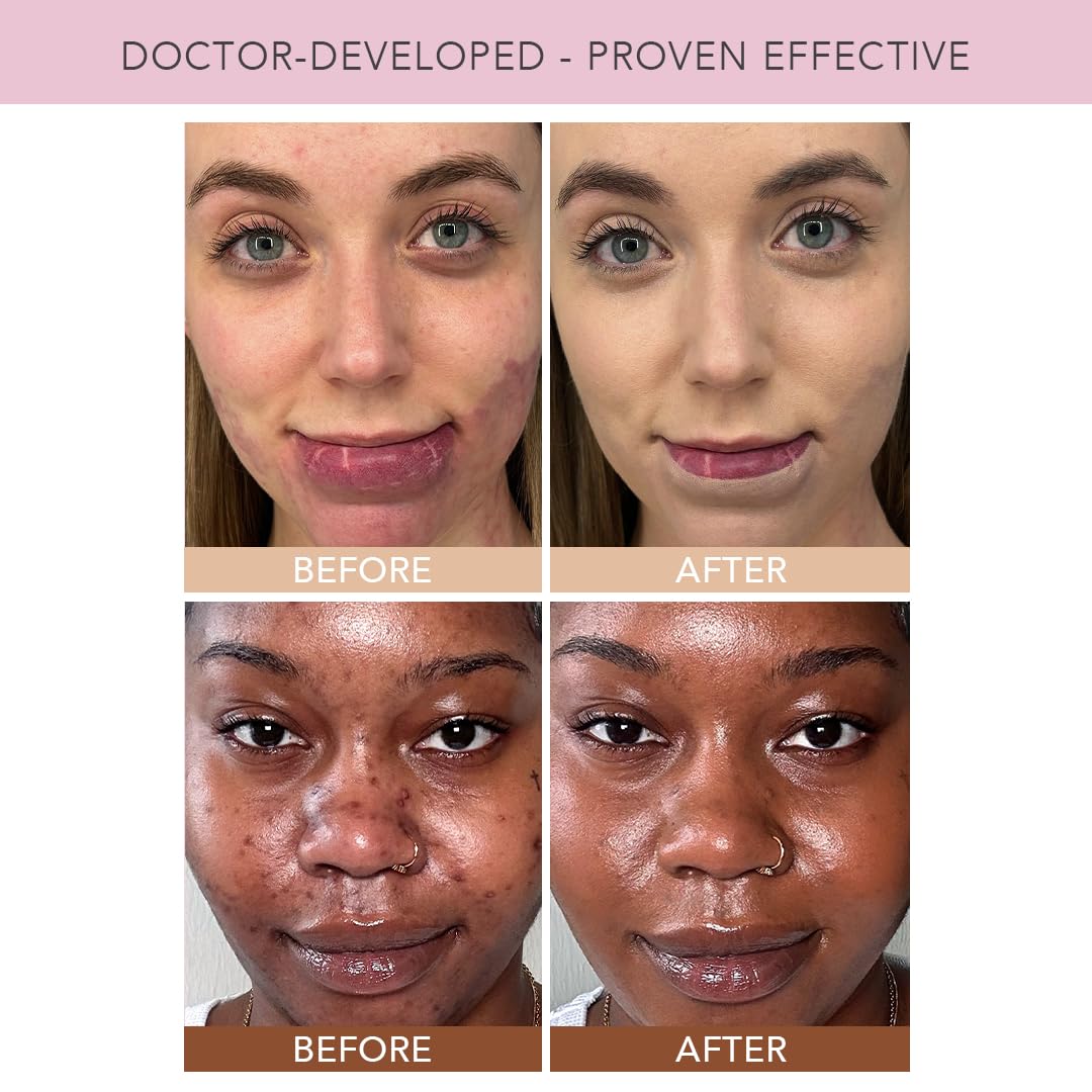 DOLL 10 NO TCE Liquid Filter CC Cream vegan clean makeup for everyday wear.