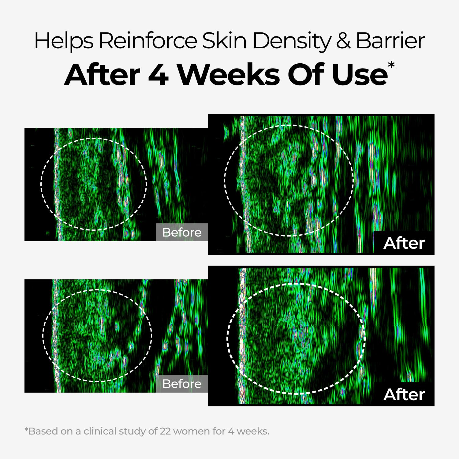 DOMINAS clinical results chart image suggesting improvements in 2-4 weeks.