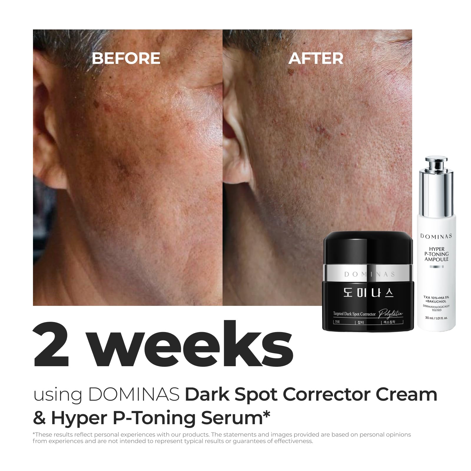 DOMINAS Dark Spot Corrector cream swirl on skin indicating hydration and glow.
