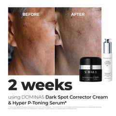 DOMINAS Dark Spot Corrector cream swirl on skin indicating hydration and glow.