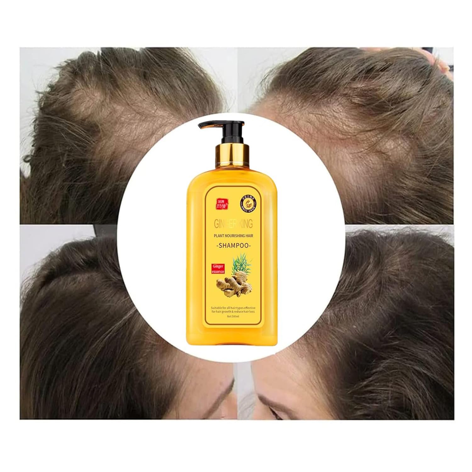 Dosoecse Ginaday Ginger Shampoo scalp-care shot implies nourishment for hair.