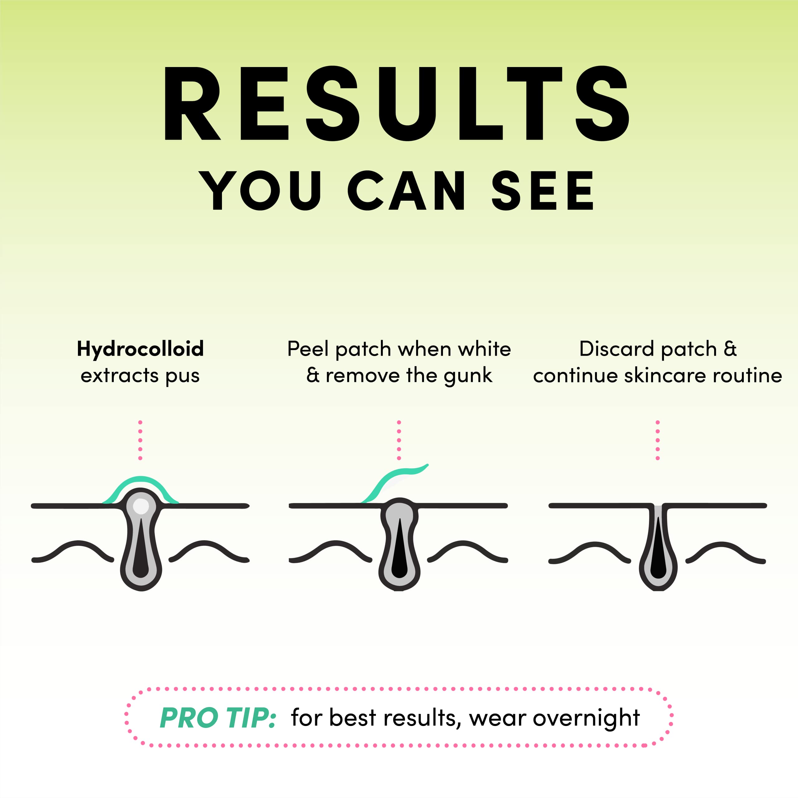 Dots for Spots patch edges blend seamlessly for comfortable use