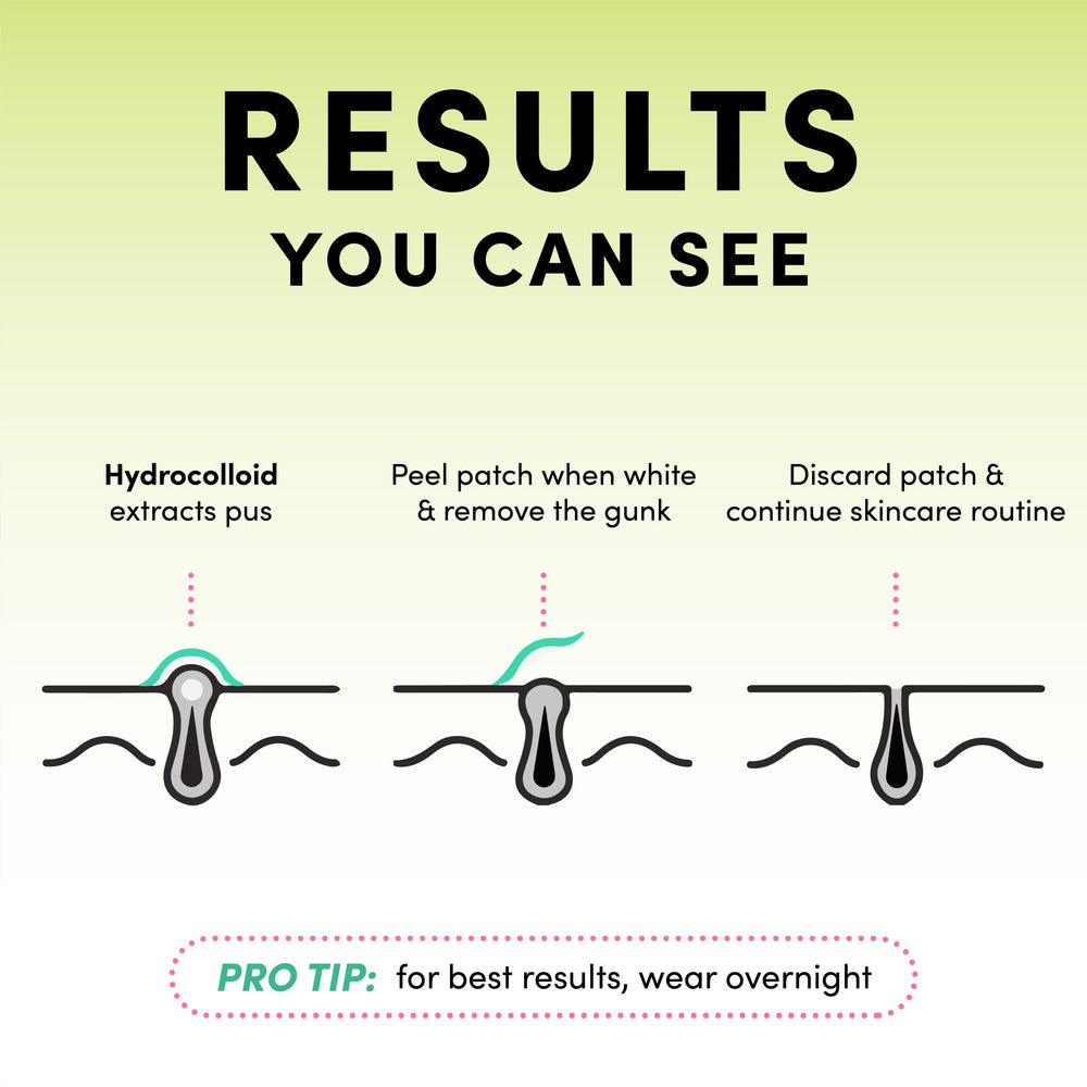 Dots for Spots patch edges blend seamlessly for comfortable use