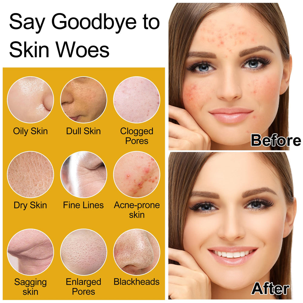 DOYEEWO cleanser bottle with rice extract for hydrating cleansing and brightening.