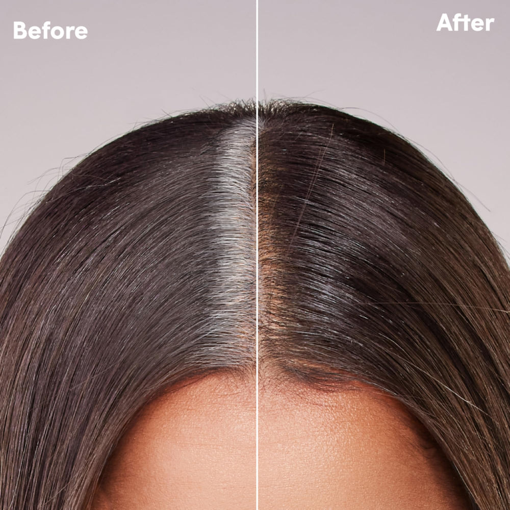 dpHUE cap in medium brown helps blend regrowth with shade.