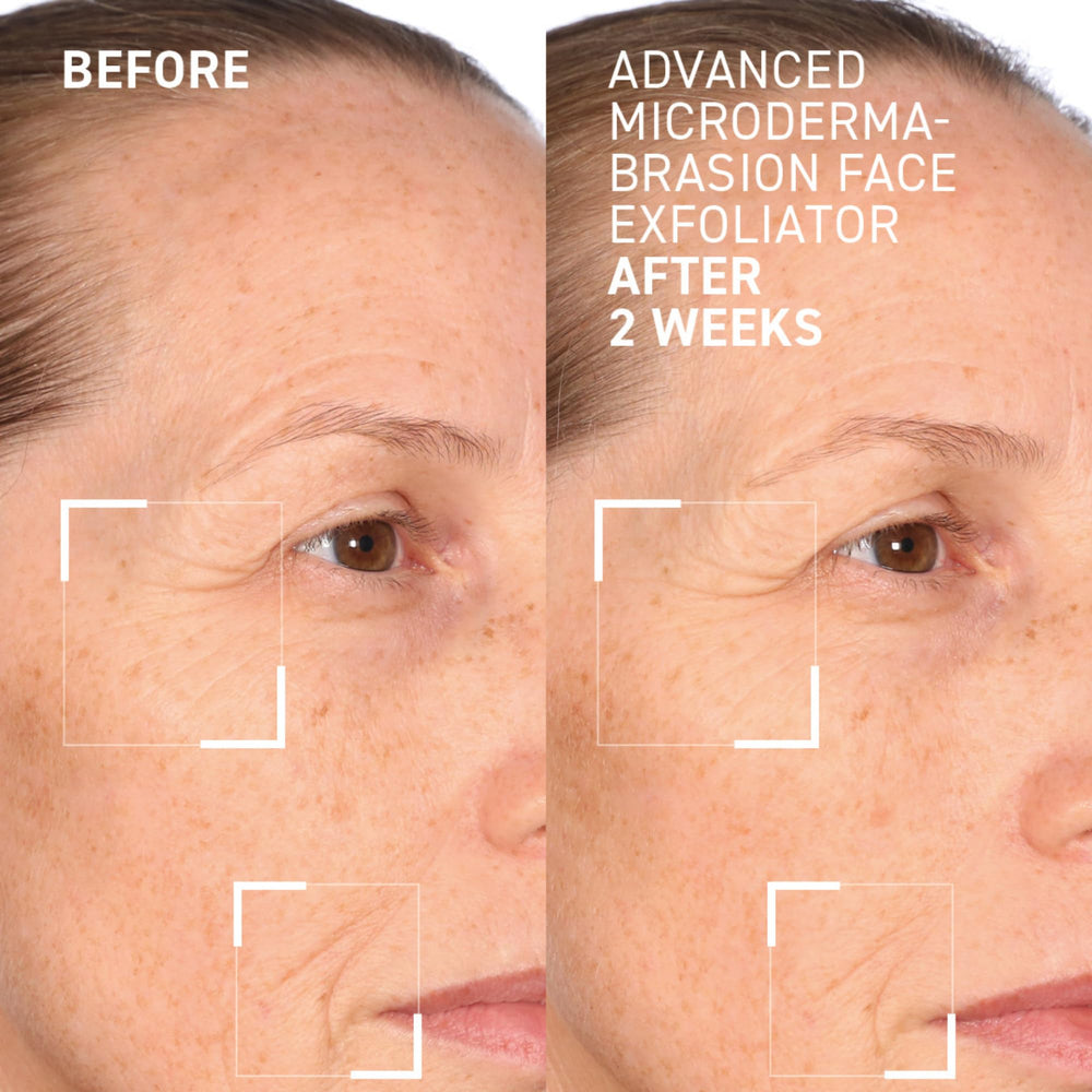 Dr. Brandt Advanced Microdermabrasion exfoliator on damp skin demonstrates massage for refined texture.