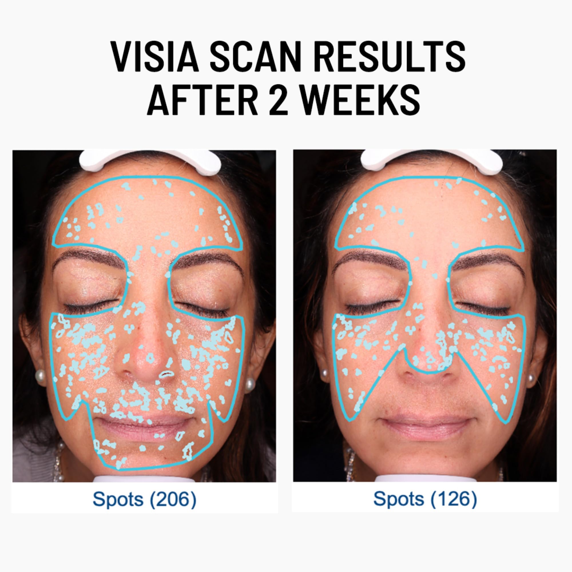Dr. Brandt Advanced Microdermabrasion exfoliator lactic acid closeup hints at renewed radiance.