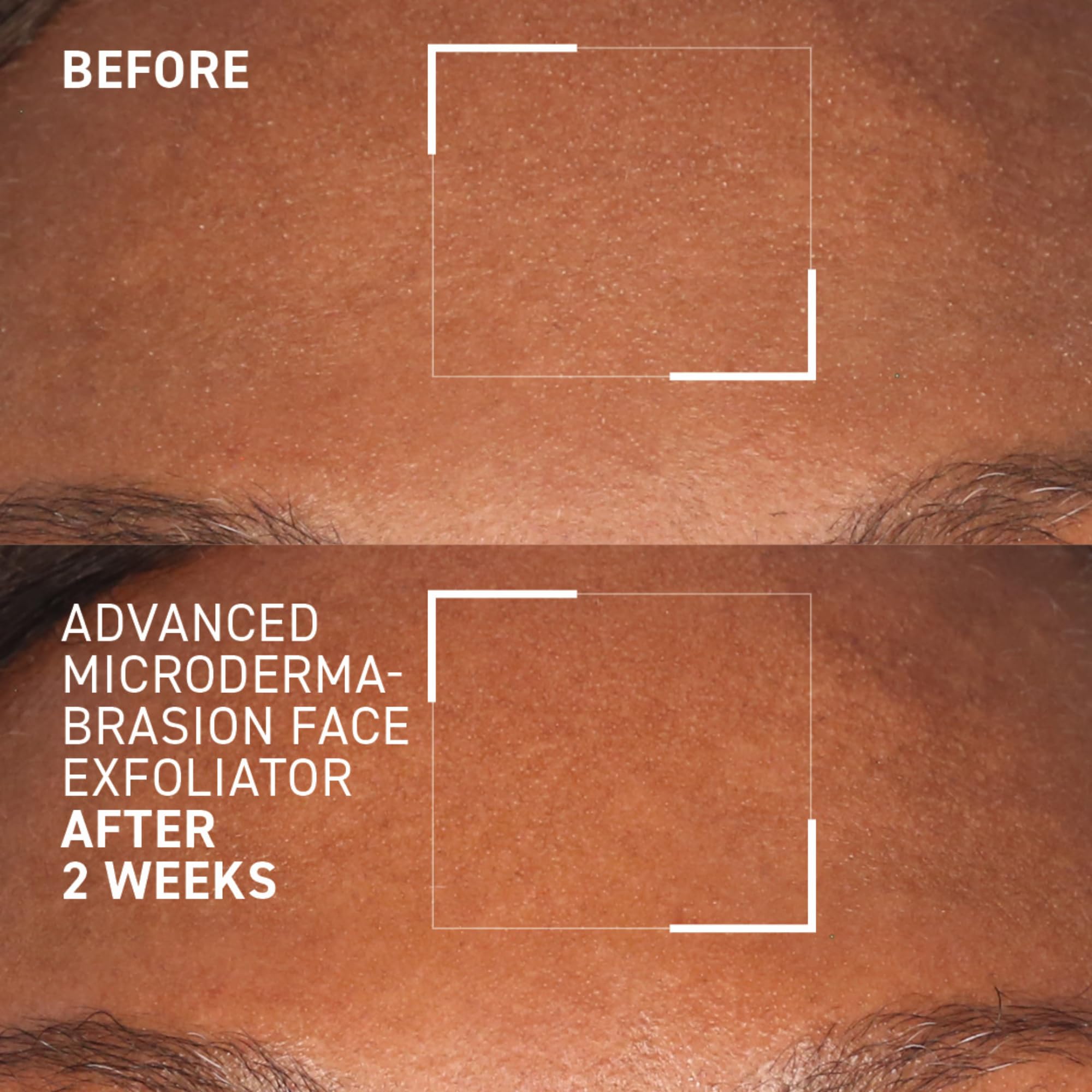 Dr. Brandt Advanced Microdermabrasion exfoliator texture-closeup suggests smoother skin with regular use.