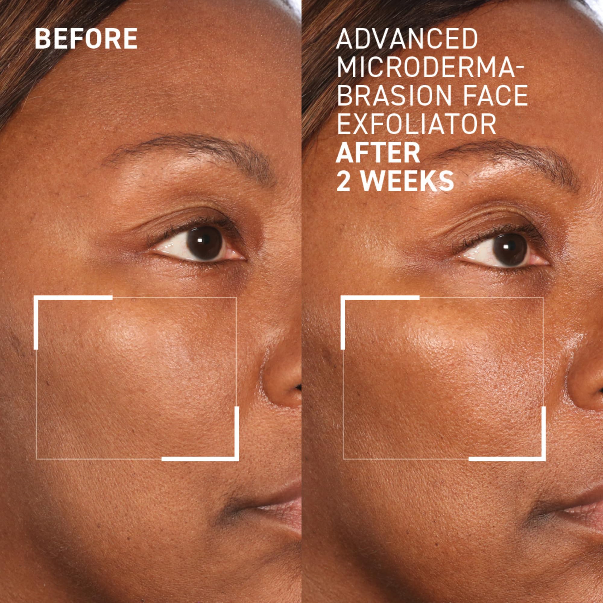 Dr. Brandt Advanced Microdermabrasion exfoliator on the tube display emphasizes professional-grade texture refinement.