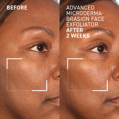 Dr. Brandt Advanced Microdermabrasion exfoliator on the tube display emphasizes professional-grade texture refinement.