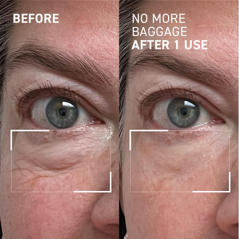 Dr. Brandt Needles No More Baggage eye-area application on dry skin shows ease.