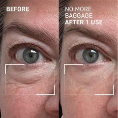 Dr. Brandt Needles No More Baggage eye-area application on dry skin shows ease.