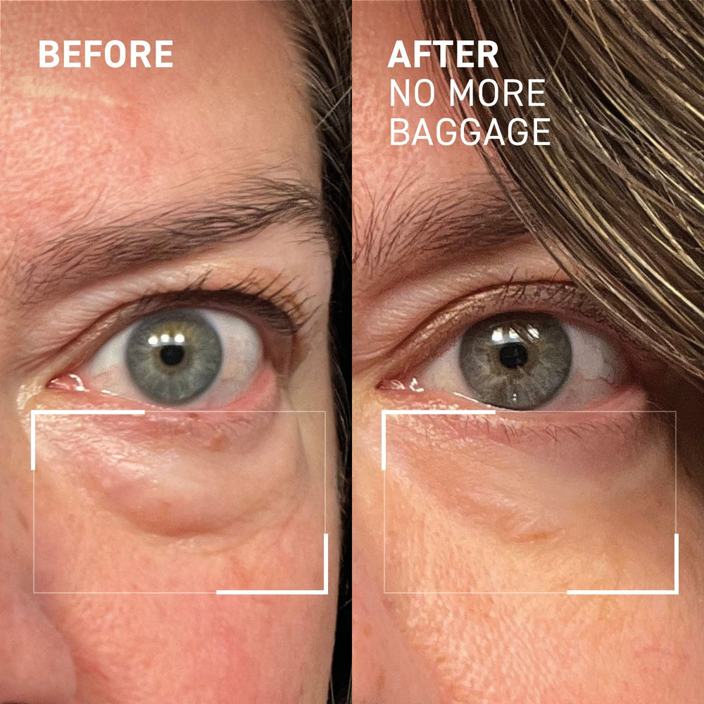 Dr. Brandt Needles No More Baggage eye-area texture detail close-up shows smoothness.