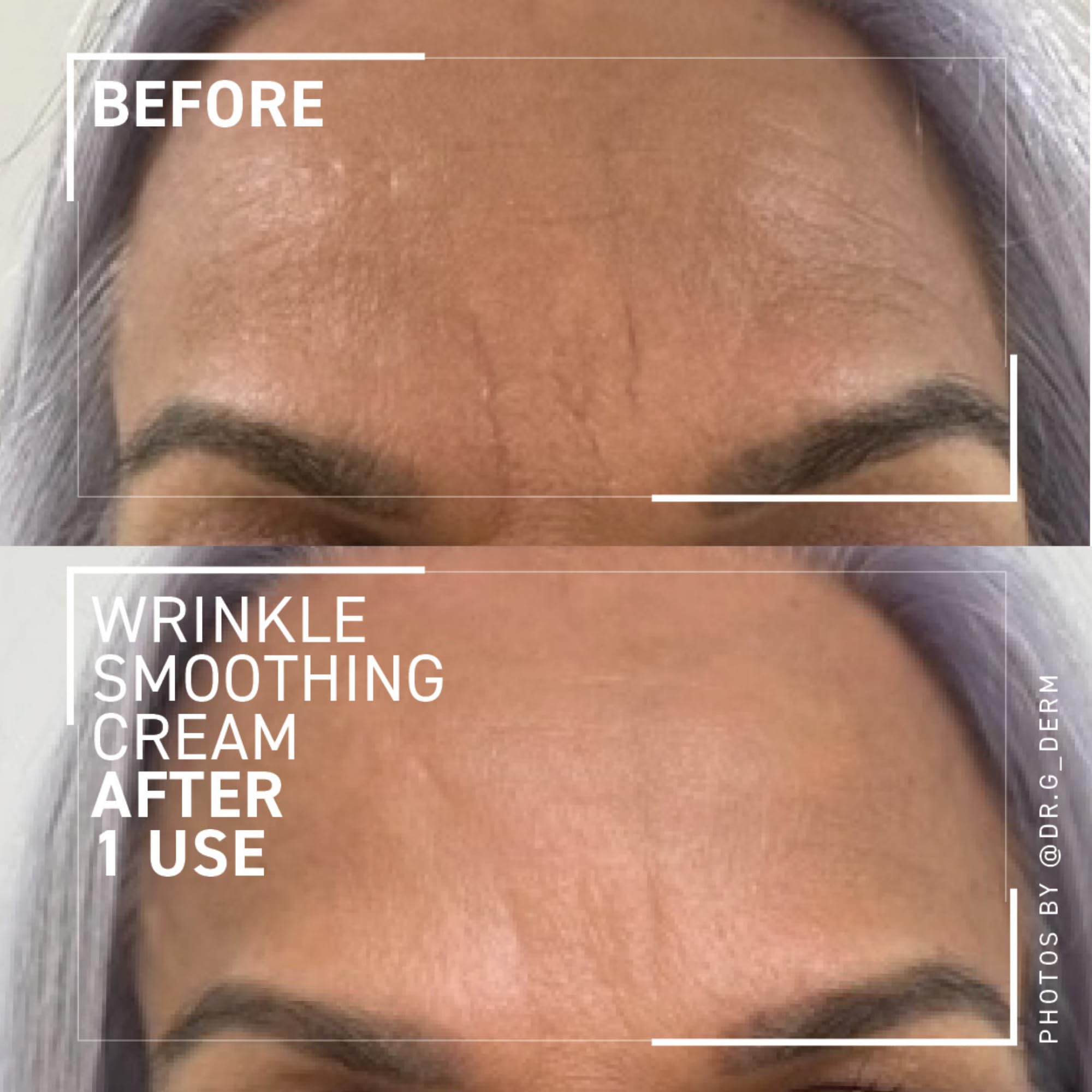 Dr. Brandt Needles No More application texture demonstrates quick absorption for busy mornings.