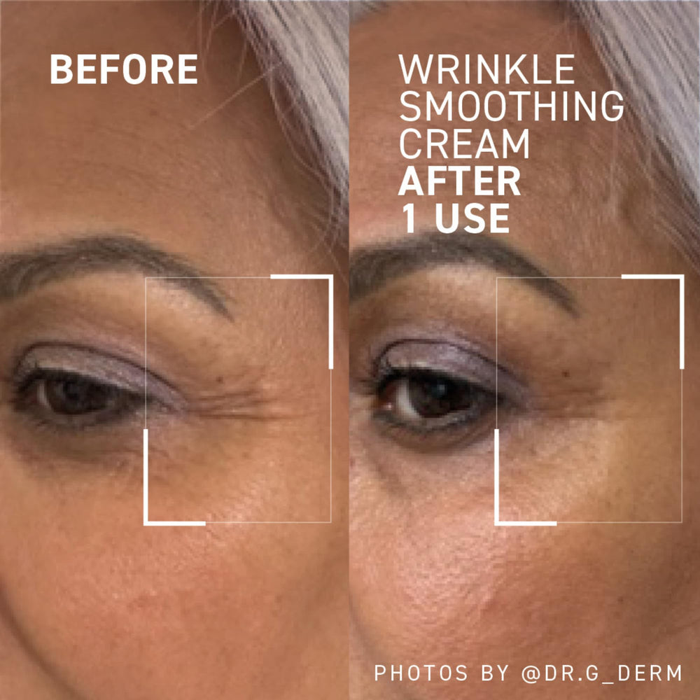 Dr. Brandt Needles No More forehead-lines area shown with potential wrinkle smoothing effect.