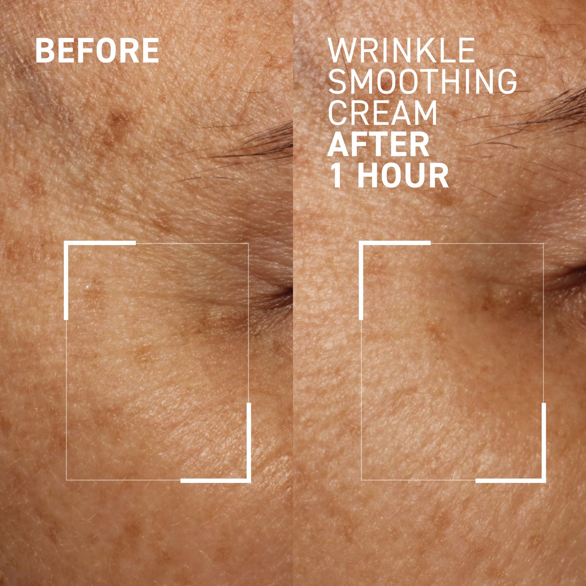 Dr. Brandt Needles No More frown-lines section illustrates precise targeted use.