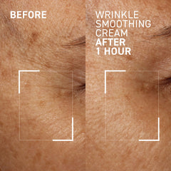 Dr. Brandt Needles No More frown-lines section illustrates precise targeted use.