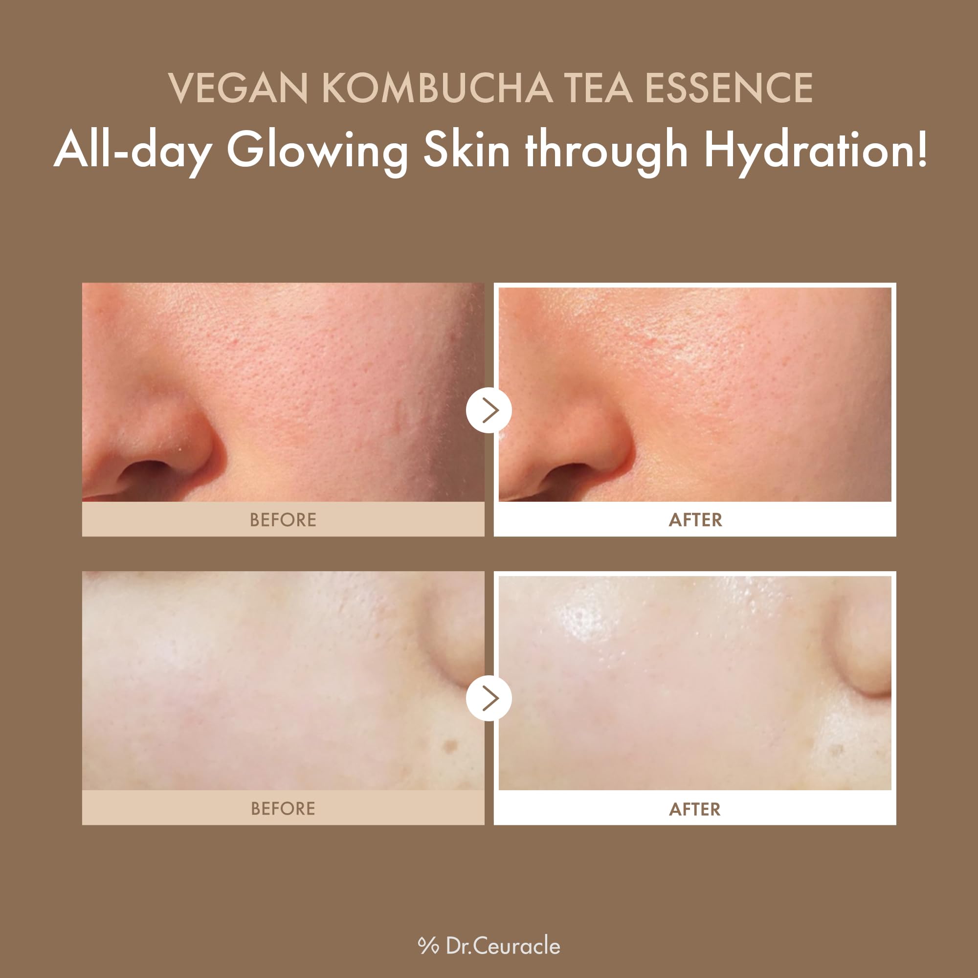 Dr.Ceuracle Vegan Kombucha Tea Essence milky texture closeup showing smooth, non-sticky hydration.
