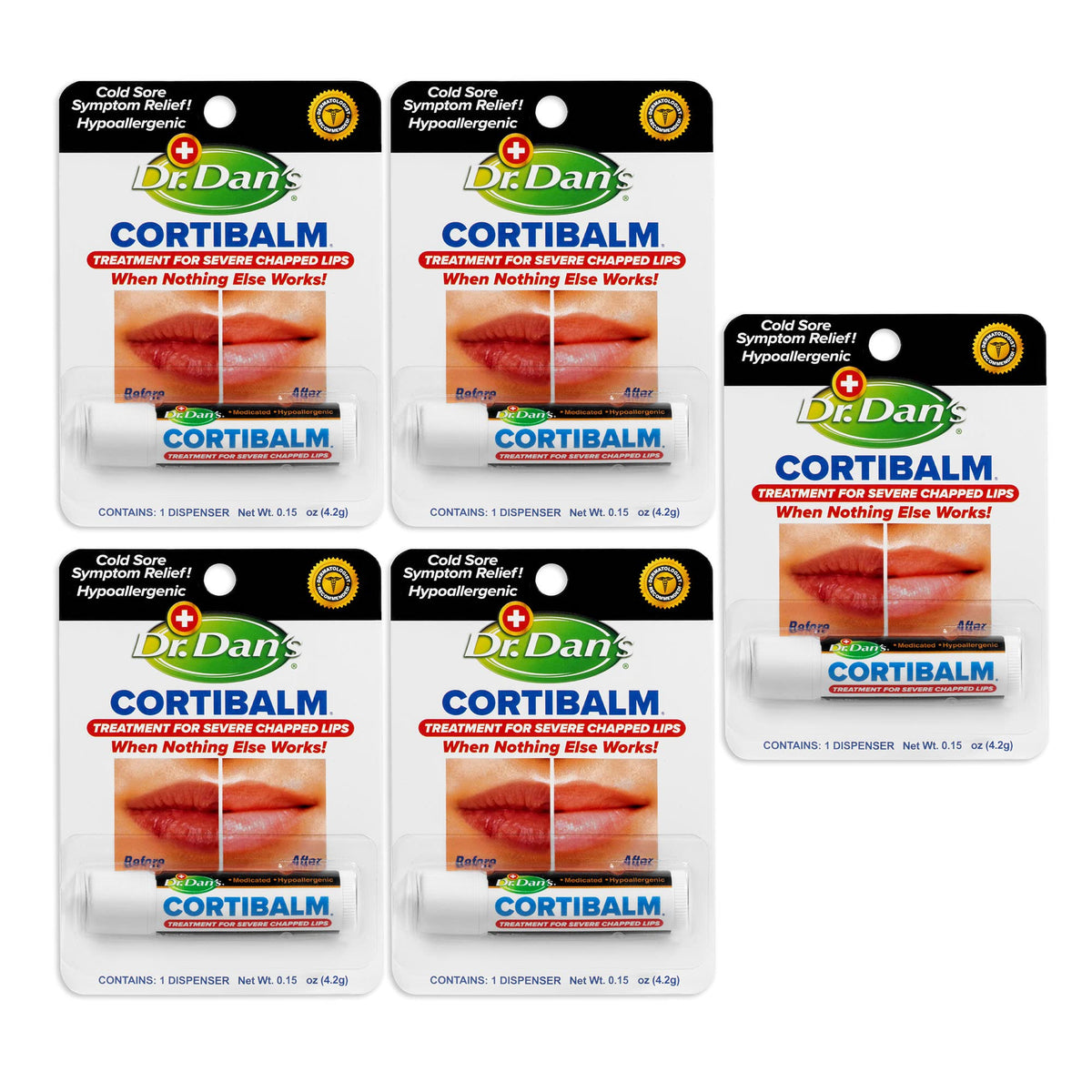 Dr. Dan's Cortibalm 5-pack tubes side-by-side for soothing lip care on severely chapped lips