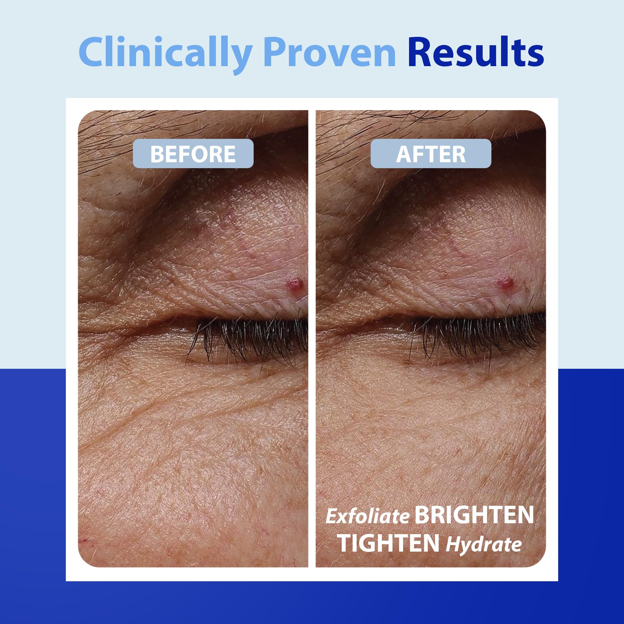 Dr. Denese SkinScience exfoliating pad image showing toner-like cleansing effect