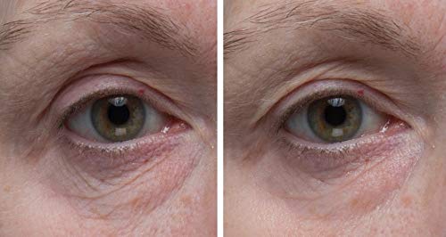 Dr. Denese SkinScience Eye Cream packaging tube highlights cruelty-free branding.
