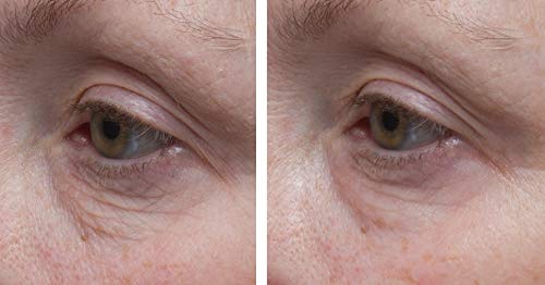 Dr. Denese SkinScience Eye Cream texture swirl highlights creamy hydration for refreshed under-eye.