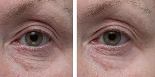 Dr. Denese SkinScience Firming Eye Cream under-eye application shows gentle lift.