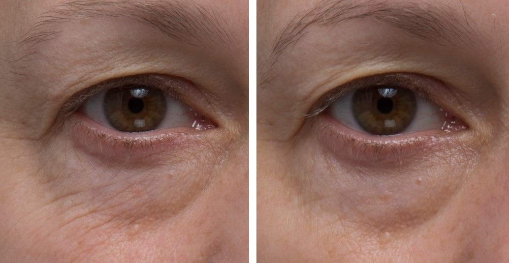 Dr. Denese SkinScience Firming Eye Cream brand logo for premium skincare cues.