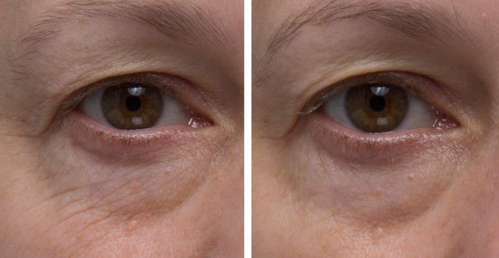 Dr. Denese SkinScience Firming Eye Cream brand logo for premium skincare cues.
