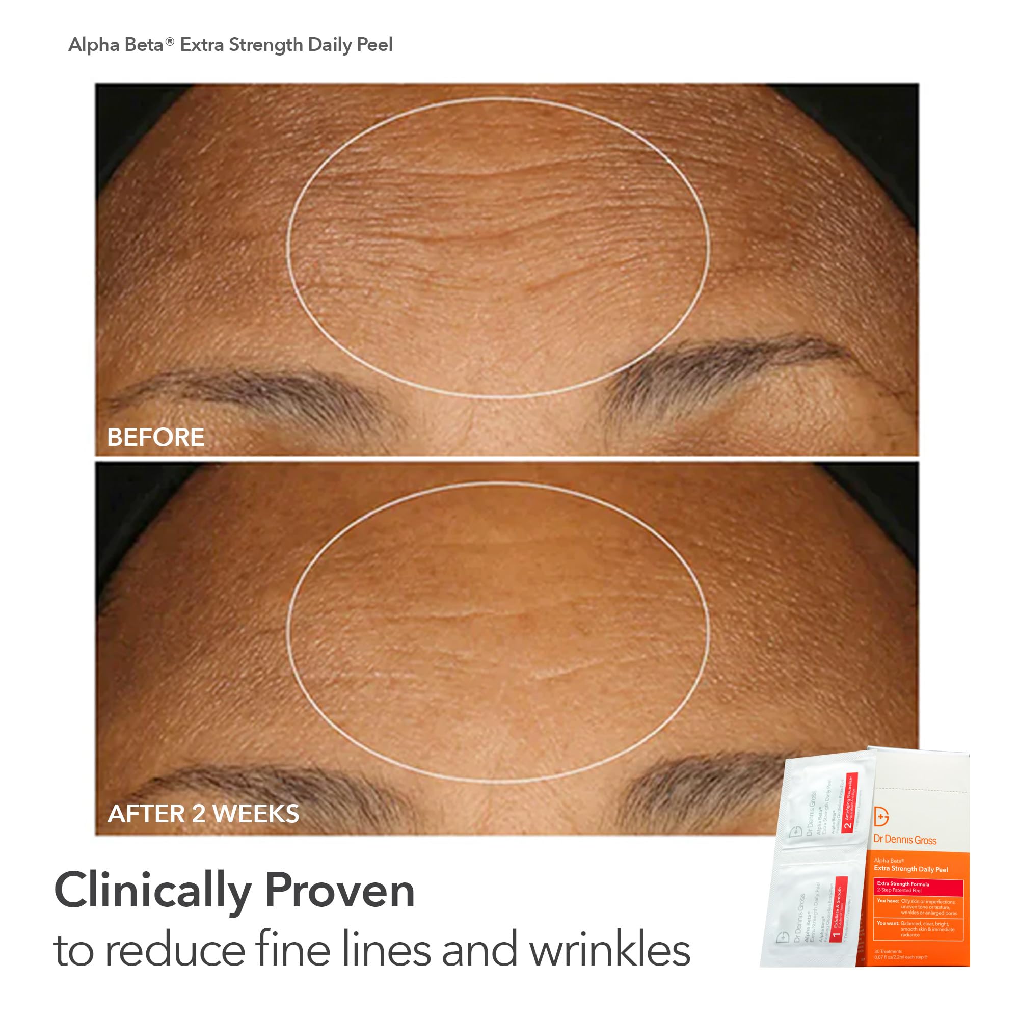 Dr Dennis Gross Peel Vault Kit 90 treatments highlights customized at-home regimen
