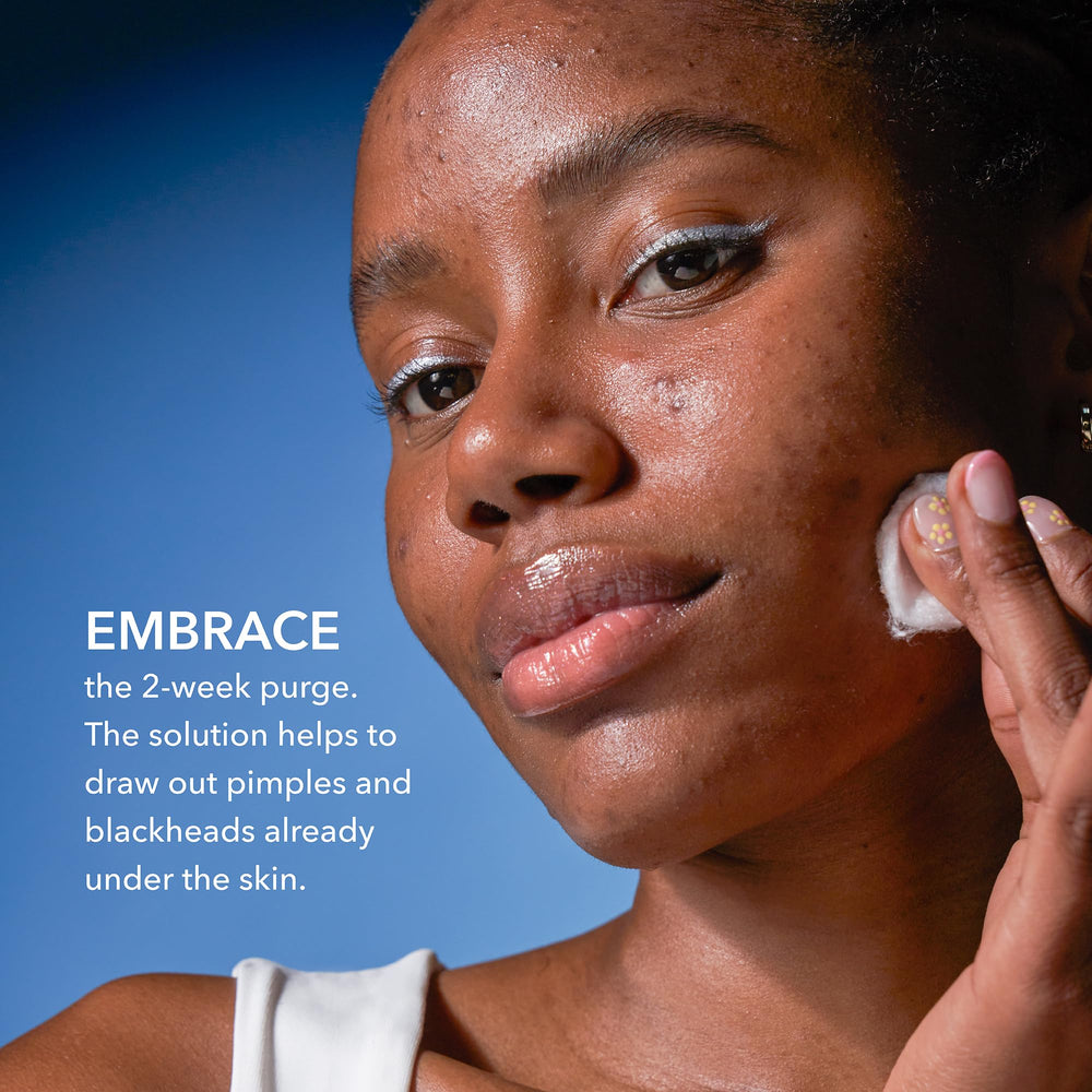 Dr Dennis Gross Alpha Beta 2% BHA+ ingredients label highlights five-acid blend for acne support